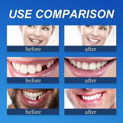 ⏰Ends Today: 70% OFF! 🌎LUMIVO™ Custom-Fit Dentures— Designed for Comfort and a Natural-Looking Smile